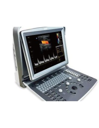 Ecógrafo portátil Chison ECO 6 con Doppler color y sonda a elección