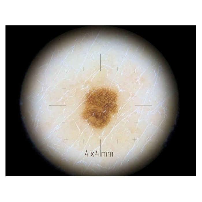 Adaptador Dermlite para área pequeña de...