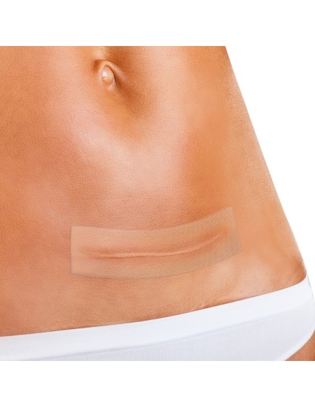 Apósito para tratamiento de cicatrices recientes y antiguas.