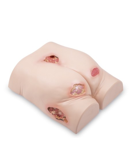 Entrenador de tratamiento de úlceras por presión | Iberomed