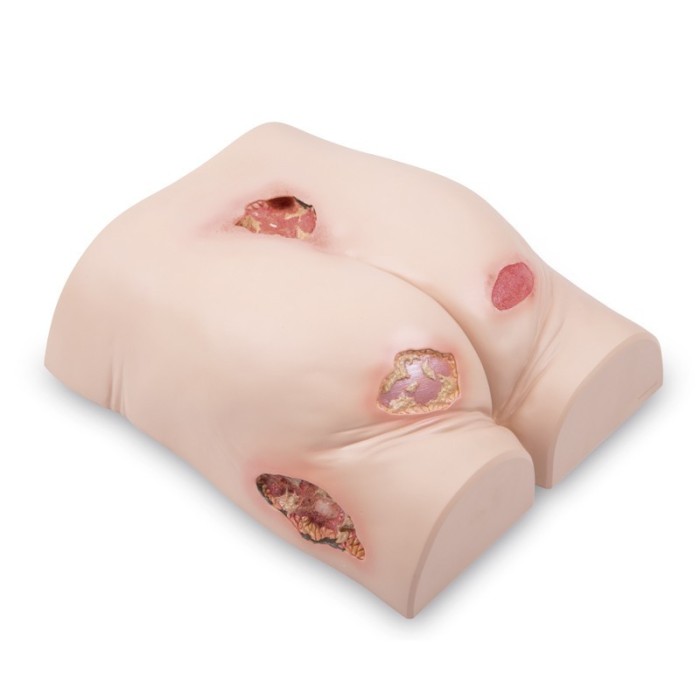 Entrenador de tratamiento de úlceras por presión