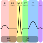 Cómo leer un electrocardiograma: guía definitiva