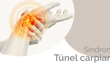Síndrome del Túnel carpiano: síntomas y tratamiento