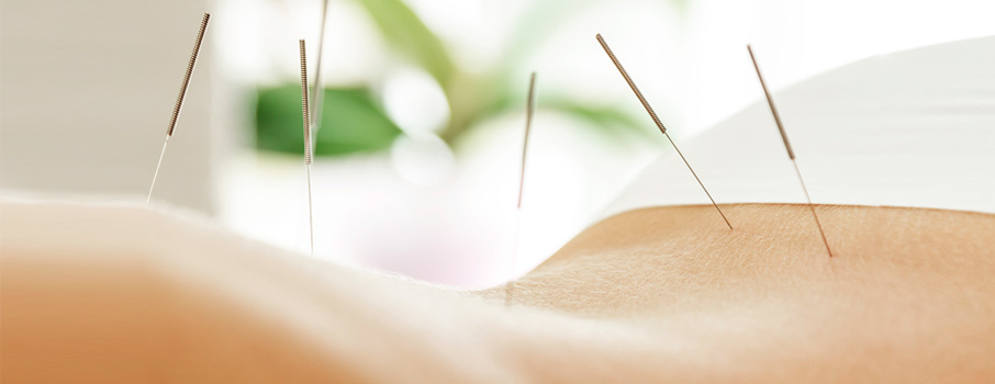 acupuntura y kinesioterapia