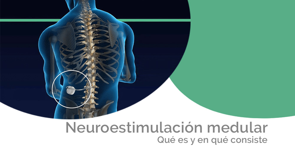 Estimulación de alta frecuencia de la médula espinal: nuevo